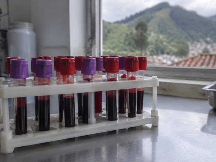 Genele populațiilor din Ecuador indică adaptarea la tuberculoză înaintea sosirii europenilor